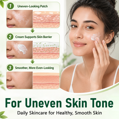 Ceoerty® Herbal Vitiligo Cream